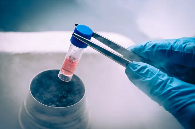 Eggs & Embryo Freezing Treatment in Noida Specialist