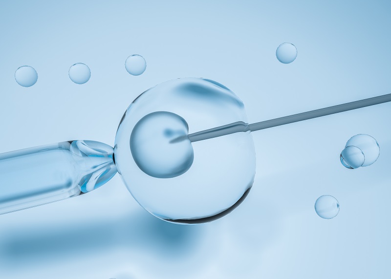 IMSI IVF Treatment in Noida Specialist